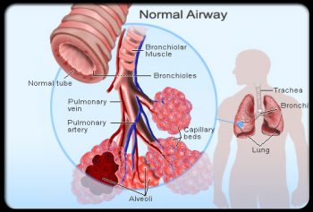 Chronic Obstructive Pulmonary Disease for the Correctional Nurse – The ...